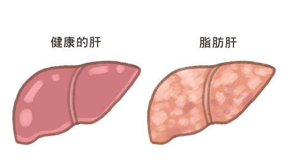 貓咪脂肪肝_4 貓咪脂肪肝_4
